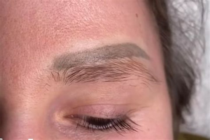 Is Matt Smith No Eyebrows linked To Cancer? Illness And Disease Update